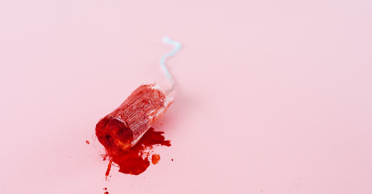 Saint-Philbert-de-Grand-Lieu : Initier les collégiens à la sensibilisation contre le tabou des menstruations